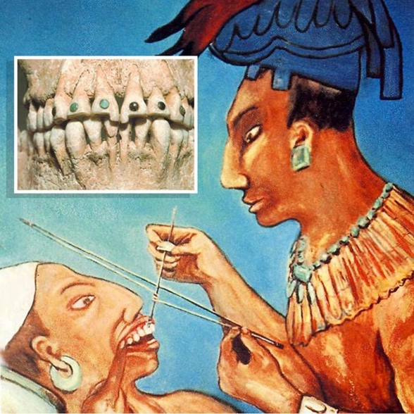 Реферат: История стоматологии
